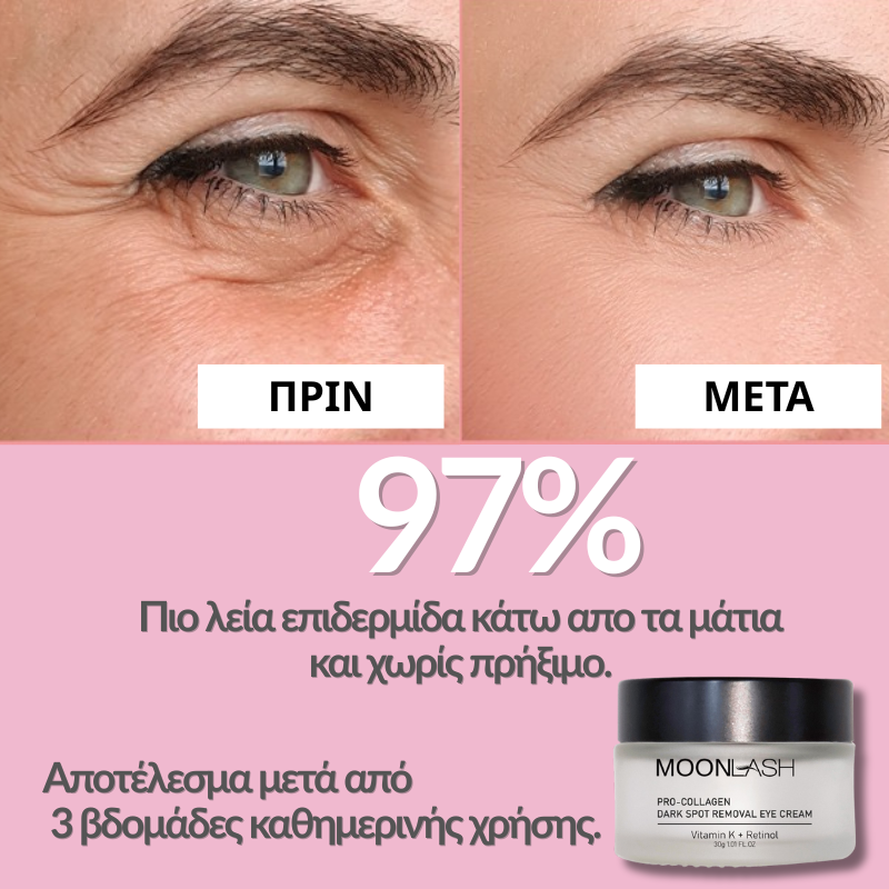 Dark Spot Eye Cream
