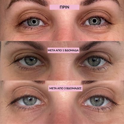 Dark Spot Eye Remover